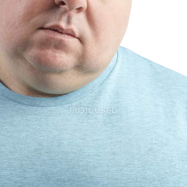Primer plano de la barbilla y el cuello del hombre con sobrepeso, recortado - foto de stock