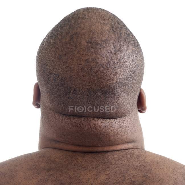Primo piano del collo uomo sovrappeso, vista posteriore
. — Foto stock