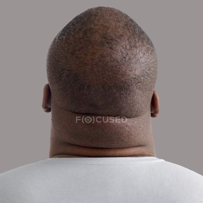 Primo piano del collo uomo sovrappeso, vista posteriore
. — Foto stock