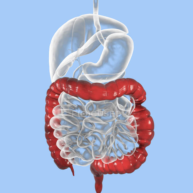 Ilustração digital do sistema digestivo que sofre de síndrome do intestino irritável . — Fotografia de Stock