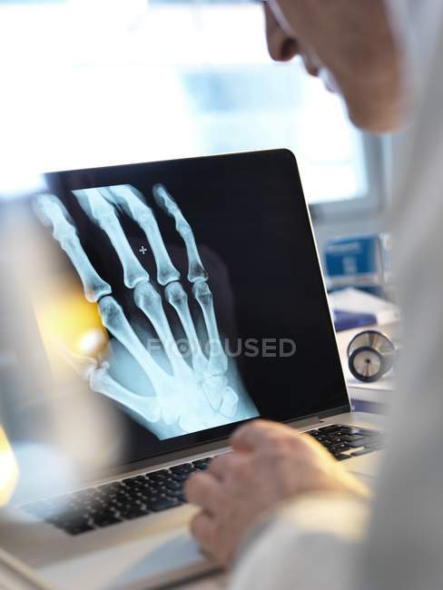 Доктор переглядає рентгенівський знімок руки на екрані ноутбука . — стокове фото