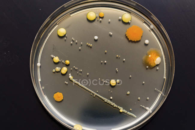 Cultura microbiológica crescendo em placa de Petri, close-up . — Fotografia de Stock