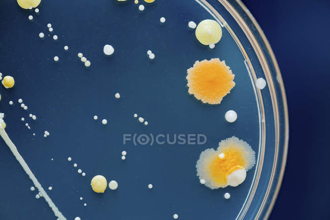 Coltivazione microbiologica in capsule di Petri, primo piano . — Foto stock