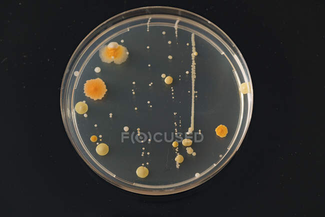 Coltivazione microbiologica in vaso di Petri
. — Foto stock