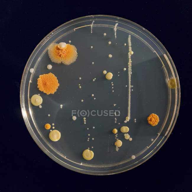 Microbiological culture growing in Petri dish, close-up. — Stock Photo