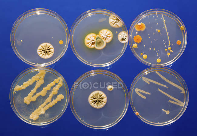 Мікробіологічні культур, які ростуть в Петрі страви. — стокове фото