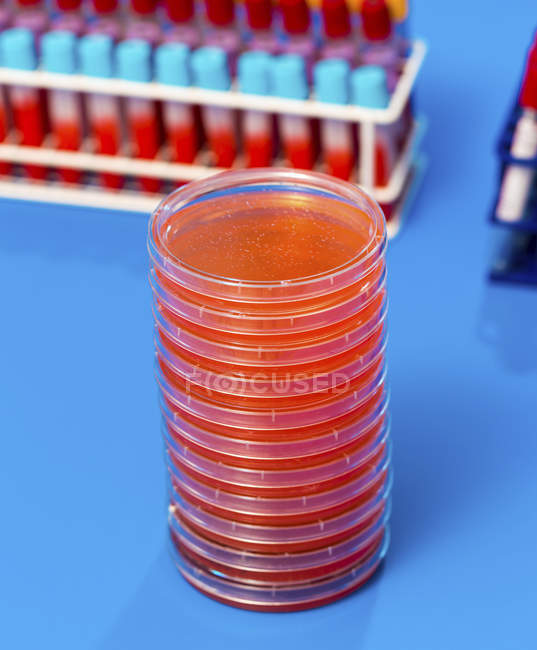 Muestras biológicas en tubos de ensayo y placas de Petri sobre mesa de laboratorio
. - foto de stock