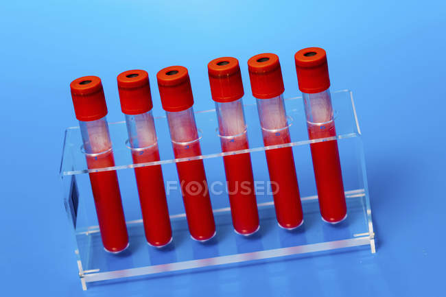 Support de éprouvettes avec des échantillons de sang sur fond bleu . — Photo de stock