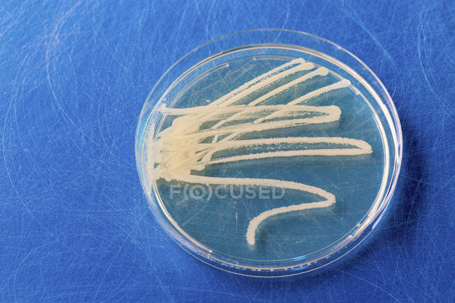 Microbiological culture growing in Petri dish. — Stock Photo