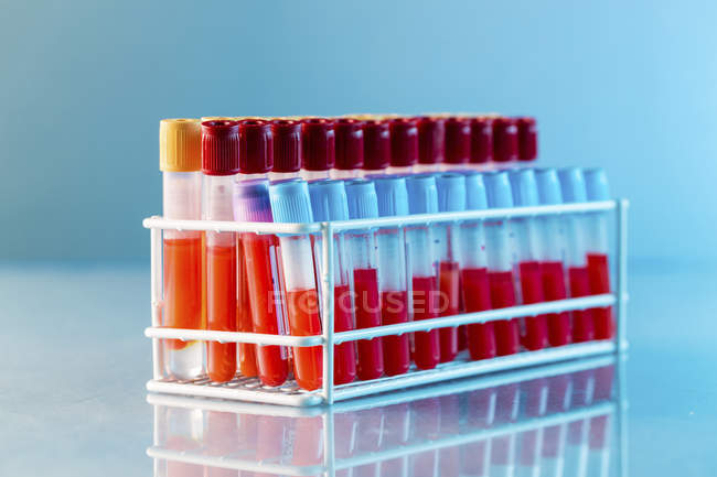 Bastidor de tubos de ensayo con muestras de sangre en laboratorio . - foto de stock