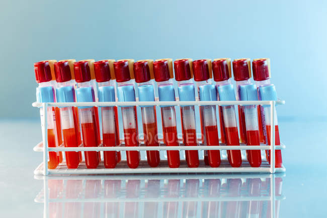 Стойка пробирки с образцами крови в лаборатории
. — стоковое фото