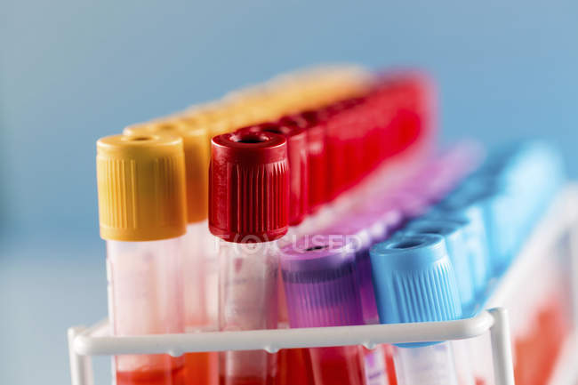 Rack de tubos de ensaio com amostras de sangue em laboratório
. — Fotografia de Stock