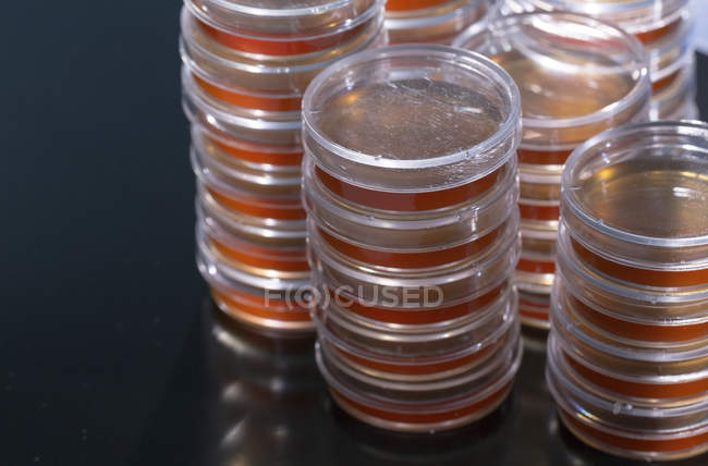 Stacked Petri dishes with blood agar on plain background. — Stock Photo