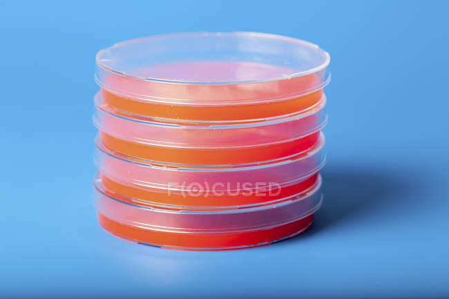 Piastre di Petri con agar di sangue su sfondo blu . — Foto stock