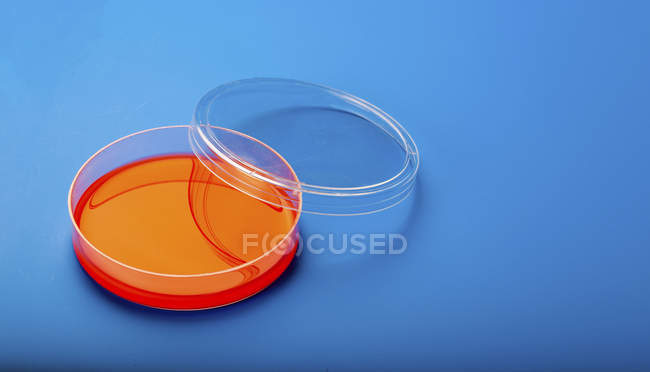 Petrischale mit Blutagar auf blauem Hintergrund. — Stockfoto