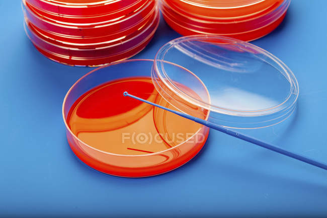 Petri dishes with blood agar on blue background. — Stock Photo