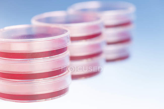 Platos de Petri apilados con muestras de sangre . - foto de stock