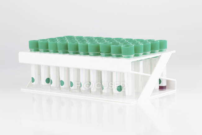 Tubos de ensaio de plástico em rack sobre fundo branco . — Fotografia de Stock