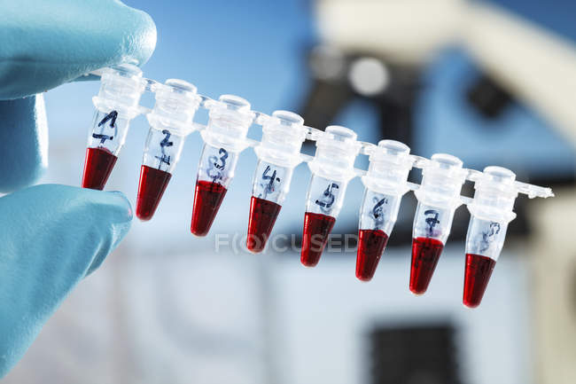 Close-up of scientist holding rack of microcentrifuge tubes with red liquid. — Stock Photo