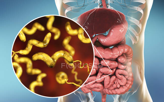 Людини, кишечника і крупний Campylobacter jejuni бактерій, що викликають Campylobacteriosis, концептуальні ілюстрації. — стокове фото