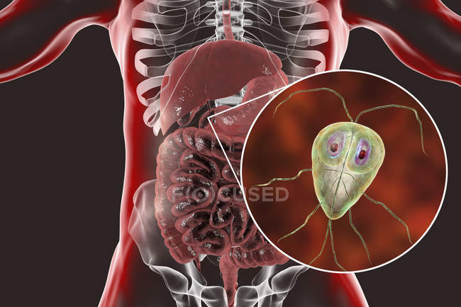 Giardia lamblia einzelliger Protozoen-Parasit im menschlichen Zwölffingerdarm, digitales Kunstwerk. — Stockfoto