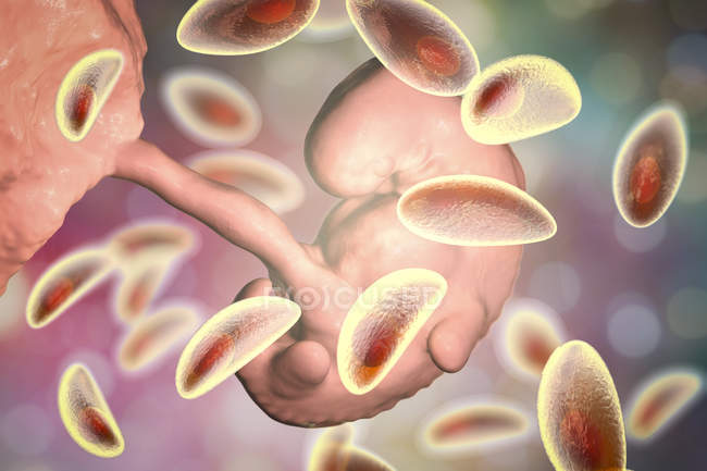 Transmisión transplacentaria de parásitos de Toxoplasma gondii al embrión humano, ilustración conceptual
. - foto de stock