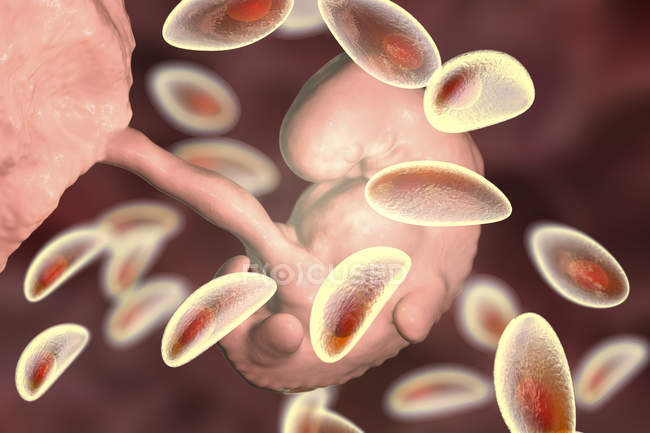 Transmisión transplacentaria de parásitos de Toxoplasma gondii al embrión humano, ilustración conceptual
. - foto de stock