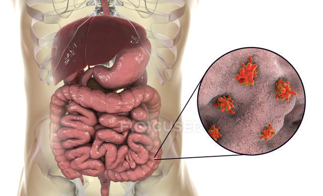 Primer plano de la ameba parasitaria en el intestino humano, obra de arte digital
. - foto de stock