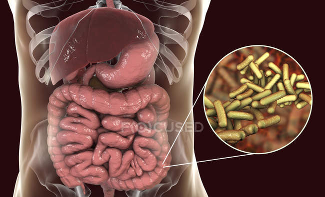 Sistema digestivo humano con infección por Shigelosis y primer plano de la bacteria Shigella
. - foto de stock