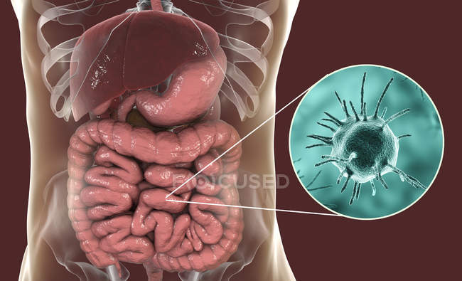 Obra digital de microorganismo patógeno abstracto en el intestino grueso humano . - foto de stock