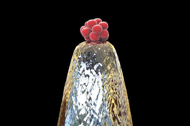 Conceptual digital illustration of human blastocyst on needle tip. — Stock Photo