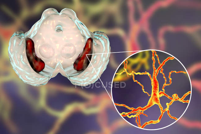 Obras de arte de sustancia negra sana y primer plano de neuronas dopaminérgicas del cerebro humano
. - foto de stock