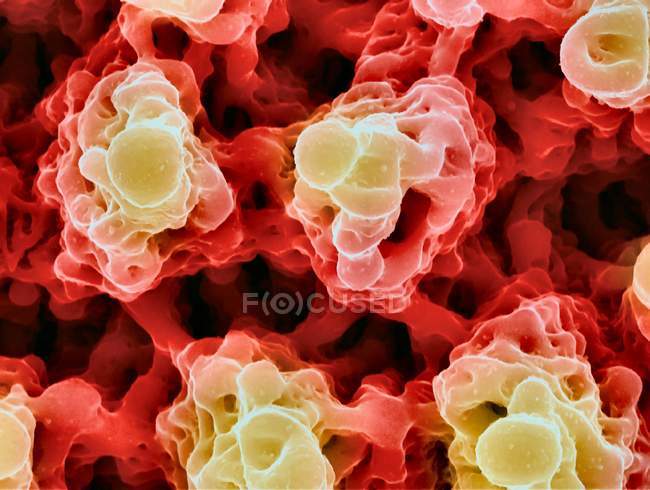 Colored scanning electron micrograph of microstructures formed on nickel surface. — Stock Photo