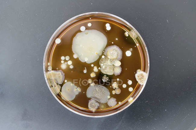 Vista superior de microbios creciendo en placa de agar . - foto de stock
