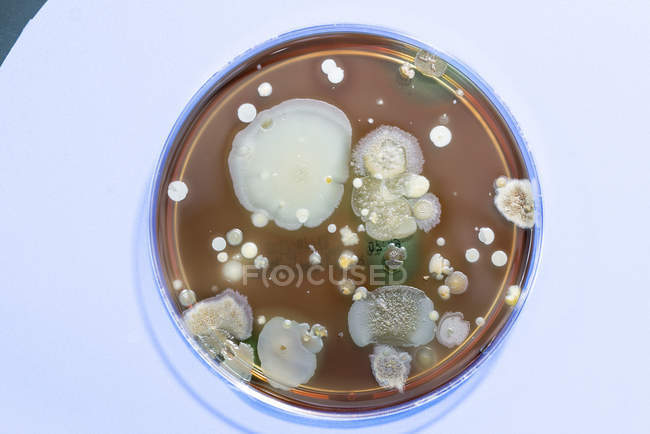 Vista dall'alto dei microbi che crescono sulla piastra di agar
. — Foto stock