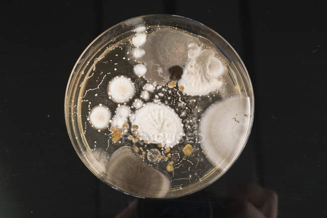 Vista dall'alto dei microbi che crescono sulla piastra di agar su sfondo normale
. — Foto stock