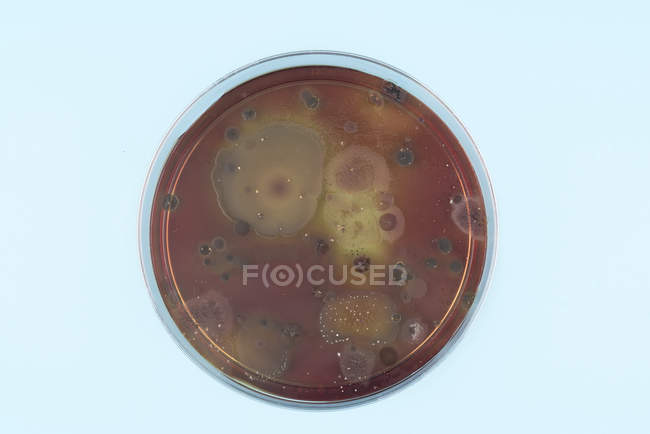 Vista dall'alto dei microbi che crescono sulla piastra di agar su sfondo normale
. — Foto stock