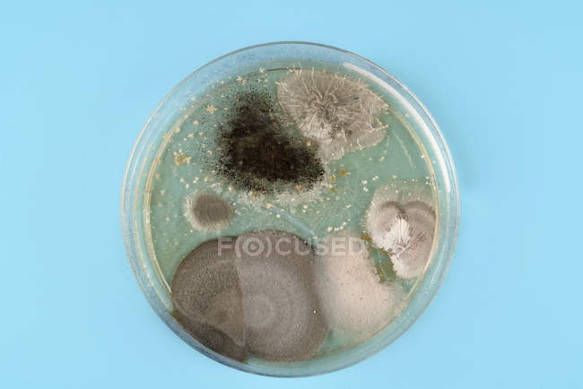 Вид зверху мікробів, що ростуть на тарілці агару на звичайному фоні . — стокове фото