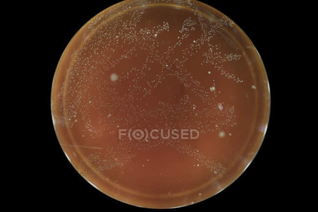 Вид сверху микробов, растущих на агарной тарелке на ровном фоне
. — стоковое фото