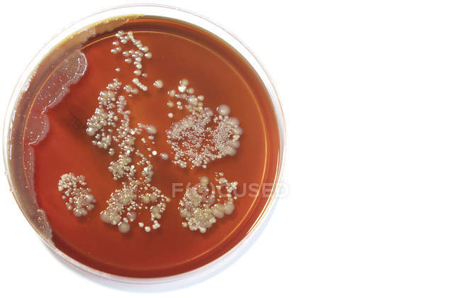 Вид зверху мікробів, що ростуть на тарілці агару на звичайному фоні . — стокове фото