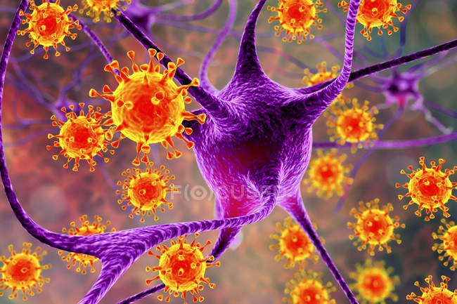 Konzeptionelle Illustration, die Viren zeigt, die Neuronen des Gehirns infizieren. — Stockfoto