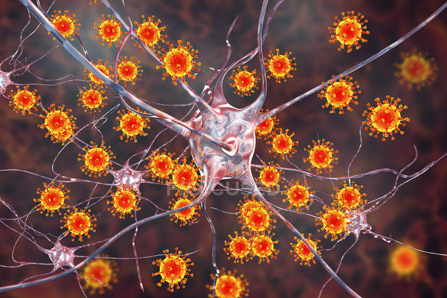 Концептуальна ілюстрація, що показує вірус, який заражає нейрони мозку . — стокове фото