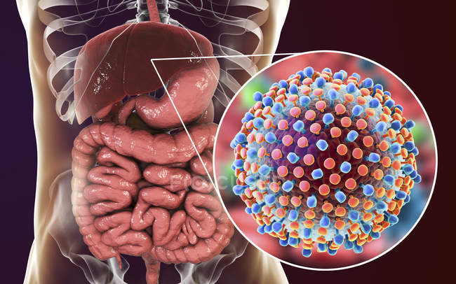 Illustration numérique de silhouette avec foie et gros plan des particules du virus de l'hépatite C
. — Photo de stock