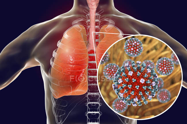 Virus de la grippe dans la trachée, illustration numérique
. — Photo de stock