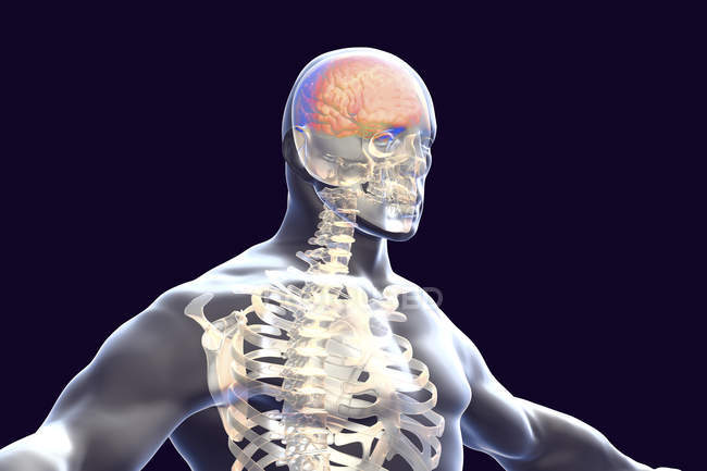 Digital illustration of brain with signs of encephalitis. — Stock Photo