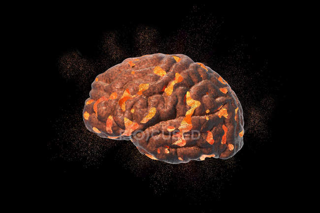 Концептуальная иллюстрация взрыва человеческого мозга
. — стоковое фото