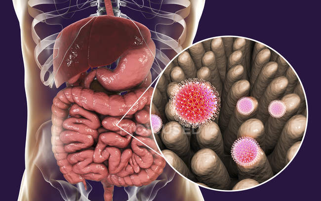 Particules de rotavirus infectant l'intestin humain, illustration numérique
. — Photo de stock