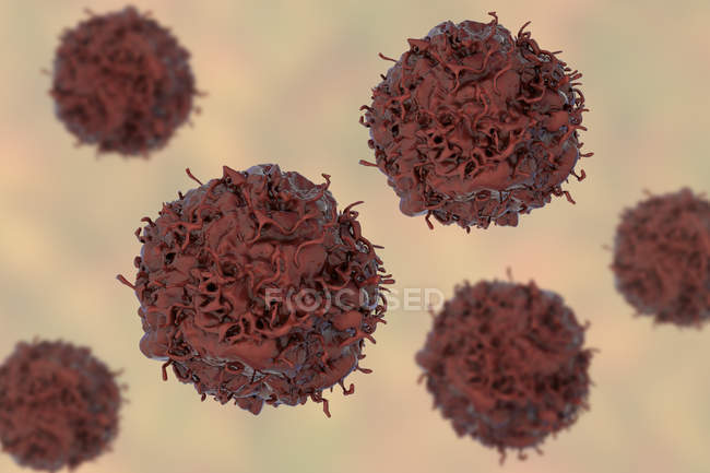 Células cancerosas pulmonares, ilustración digital
. - foto de stock