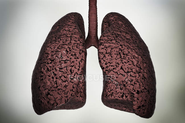 Silhouette de poumons de fumeurs malsains, illustration numérique
. — Photo de stock