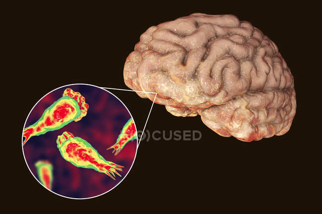 Illustration of Naegleria fowleri brain-eating amoeba protozoans infecting the brain. — Stock Photo